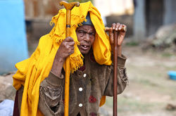 Impoverished homeless man