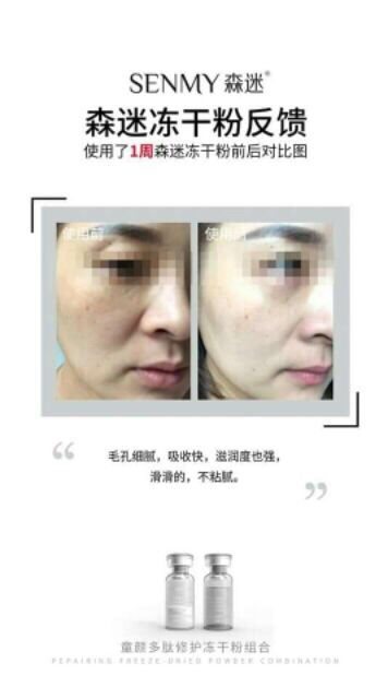Thumbnail: 森迷冻干粉组合