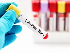 Colesterol alto: nada de ficar em pânico