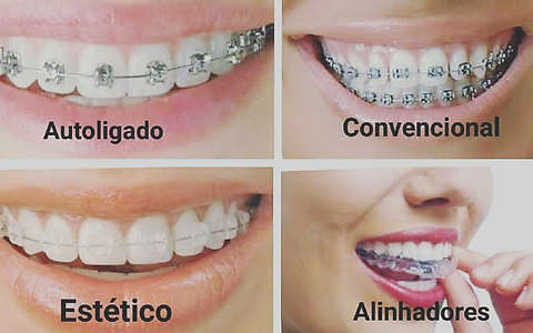 APARELHOS.png