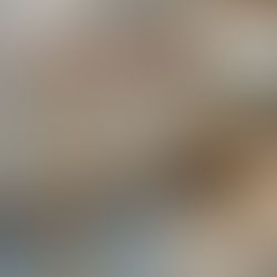                   Parallel Bar - EEFE013