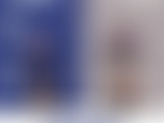 Making the Connections: A history of hypermobility research  new study out! SEDSConnective webinar