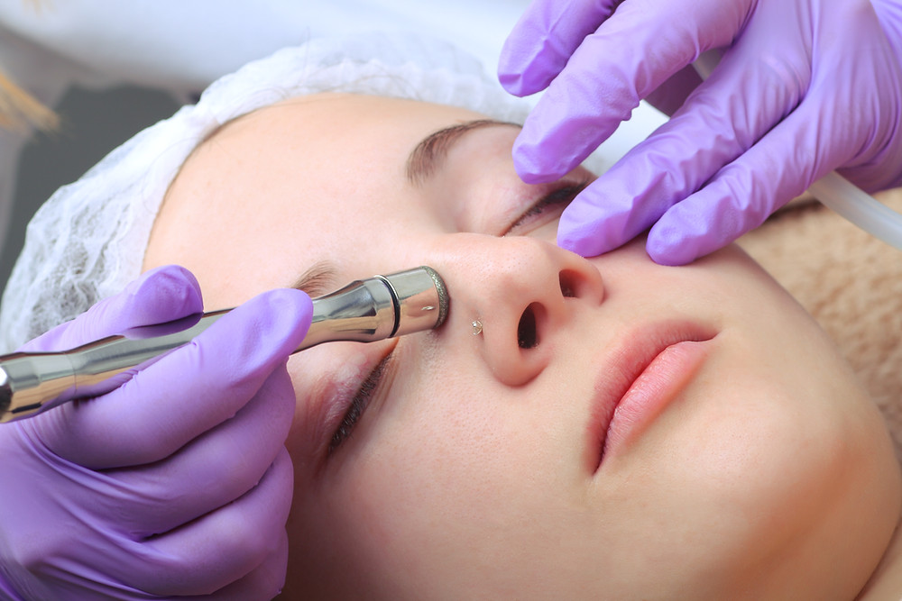 Tratament microdermabraziune