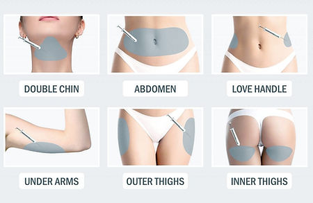 Mesolipo-Fat-Melting-Injection.jpg