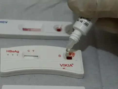 Droga injetável contra HIV é eleita descoberta de 2024 pela revista Science