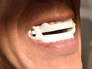 Current Perspectives in Treatment of Obstructive Sleep Apnea with Mandibular Advancement Devices: A Narrative Review