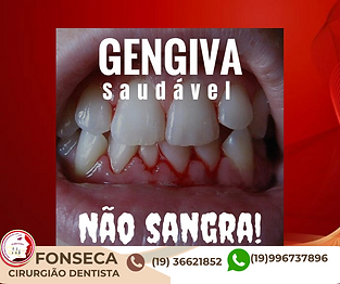 Gengiva saudável não sangra!