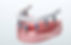 Dentures, Chipped Tooth, Orthodontics