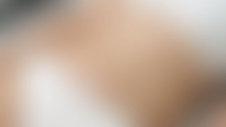 Lipo Hd, Clínica CEYS