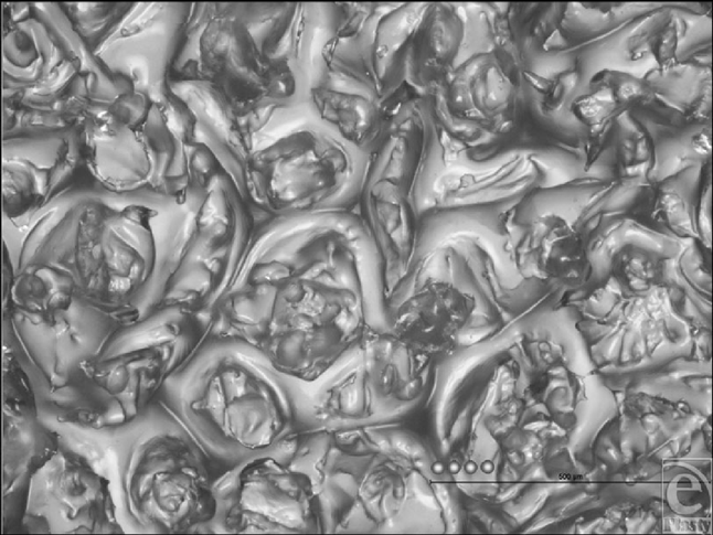 eplasty09e22_fig17.gif