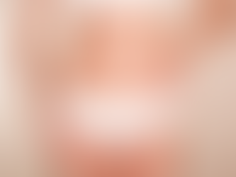Beyond Aesthetics: Health Benefits of Liposuction Surgery in Dubai