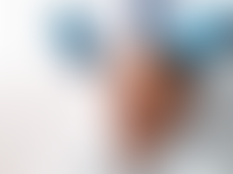 Factors That Impact Hair Transplant Price Disparities