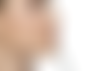 Age Gracefully with Botox: How Dubai Residents Are Embracing Preventive Beauty