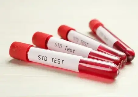 STD Testing for Beginners: Dubai Residents' Guide