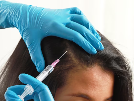The Science Behind Stunning Hair: Plasma Injections Hit Dubai