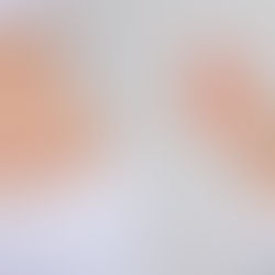 Revolutionizing Body Sculpting: Fat Dissolving Injections 101