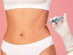 fat dissolving needles