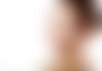 Natural Alternatives to Skin Whitening Products: Dubai's Healthy Options