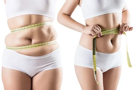 Liposuction for Body Positivity: Empowering Individuals in Dubai's Community