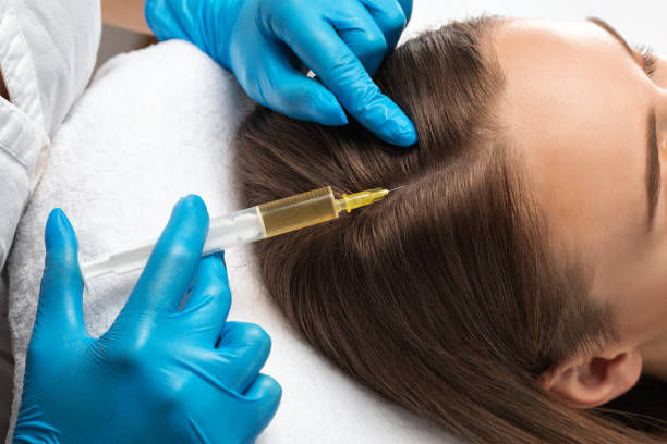 Plasma injections for hair in Dubai