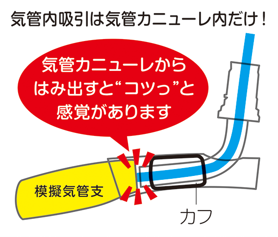 カニューレにコツッ.gif