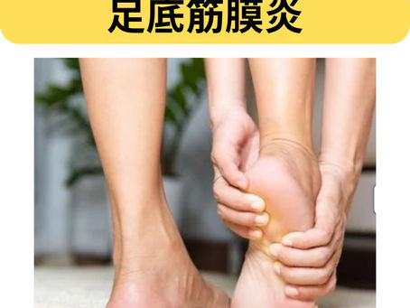足底筋膜炎について