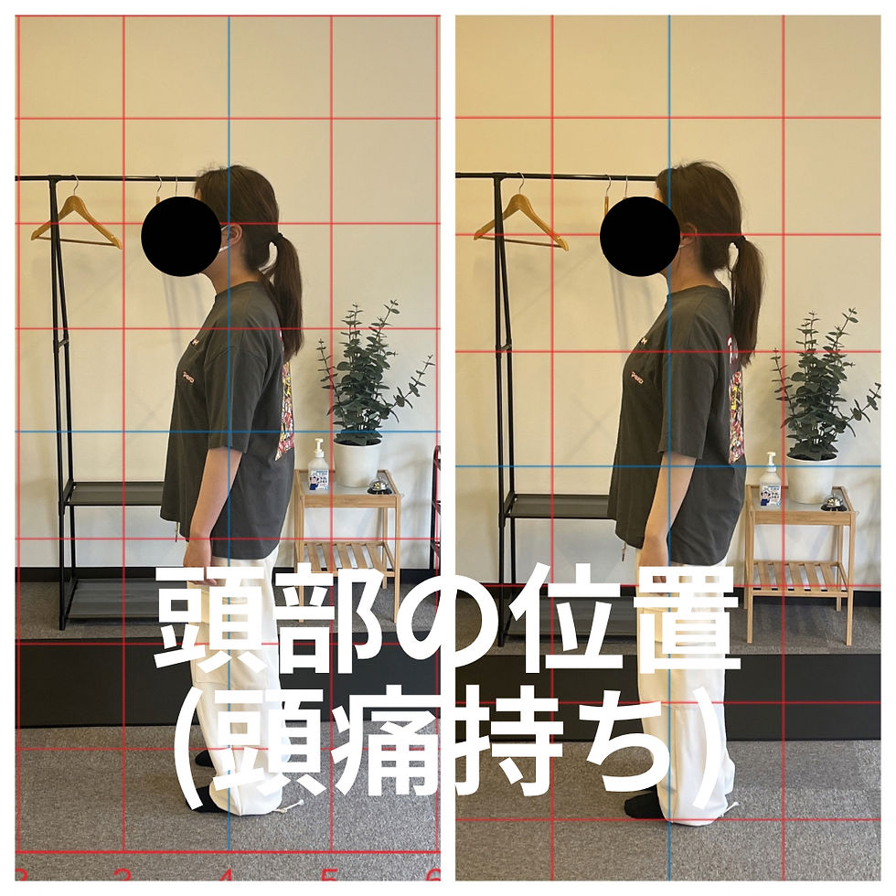 頭部の位置