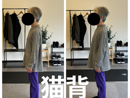 猫背