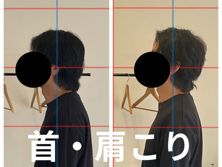 首・肩こり