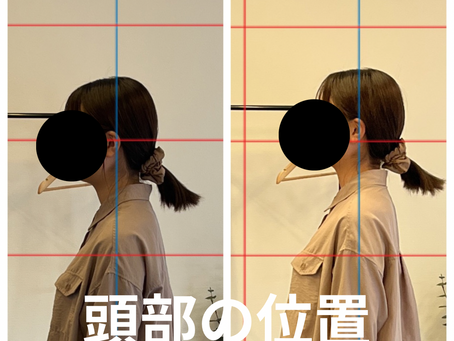 頭部の位置