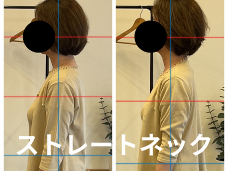 ストレートネック