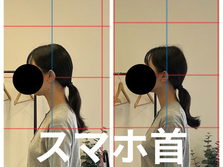 スマホ首