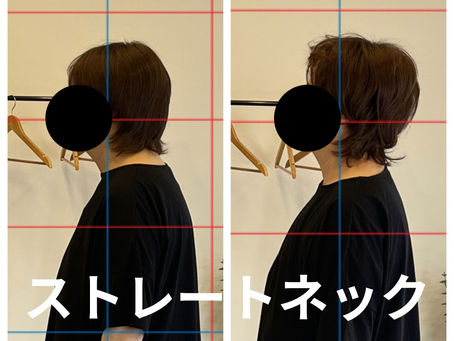 ストレートネック