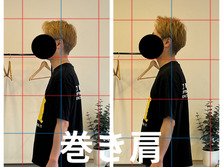 巻き肩