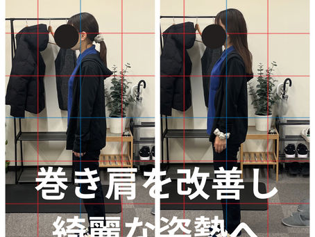 巻き肩を改善し、綺麗な姿勢へ