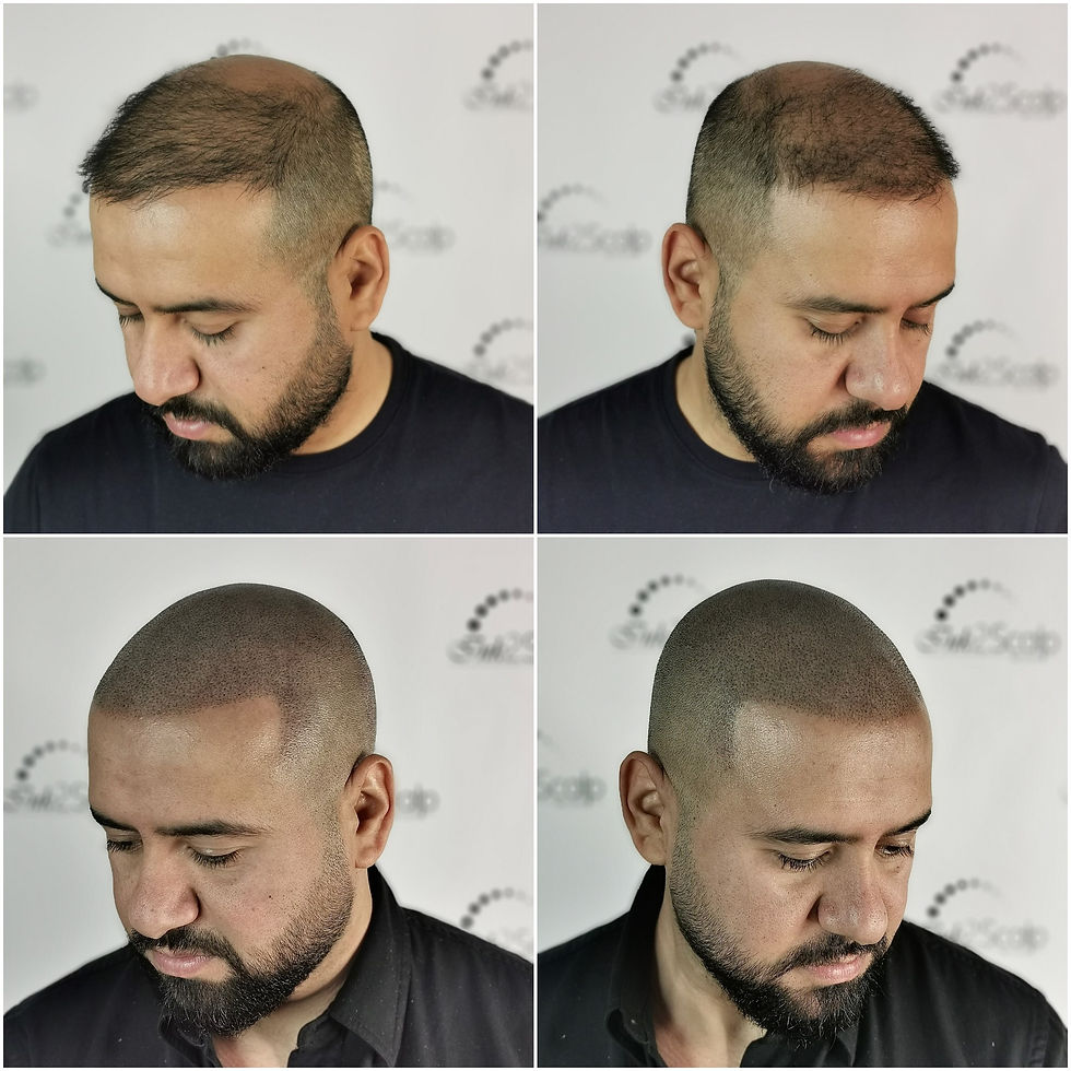 before and after picture