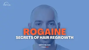 Unlocking the Secrets of Rogaine (Minoxidil): The Science Behind Hair Regrowth