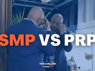 Scalp Micropigmentation Vs. Platelet Rich Plasma Hair Treatment