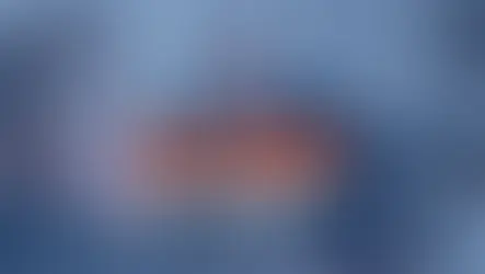 Is Scalp Micropigmentation painful?