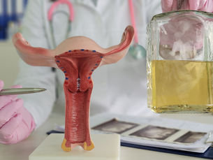 Hidrossalpinge e Gravidez Pós-FIV: Ainda Pode Atrapalhar? Entenda na SEMEAR fertilidade