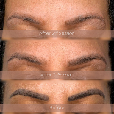 A delicate process that softly fades old ink, making space for something new.