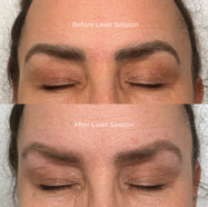 Safe removal. Clean canvas.