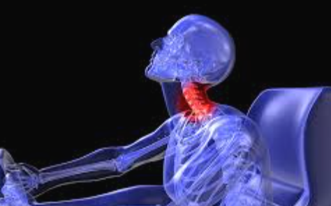 Ultimate Guide: Chiropractic Care After Car Accidents