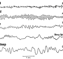 Brain-Waves.png