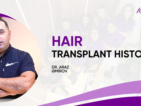 Hair transplant history