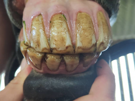 Incisor malocclusions