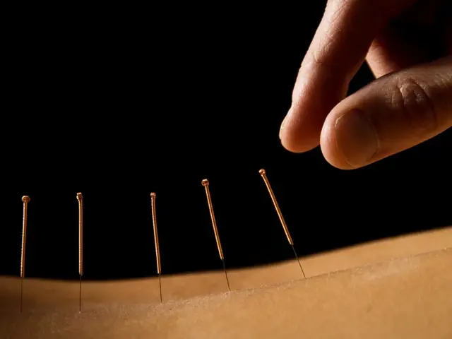 The first time I resourced to acupuncture as a way to find some relief from chronic pain my neck and back were so inflamed that you could actually see a hump on my upper back right over my shoulders and it had so much fluid it felt squishy to the touch. Being so uncomfortable kept me up at night, and I was paying the price for that during the day. Feeling extremely tired, and unable to focus, I knew I needed help. A colleague who's dad is a chiropractor and acupuncture practitioner made a complementary appointment for me to try acupuncture as a way to find some relief. I did not know what to expect, and the thought of being poked with tiny needles did not excite me at all. So, i had to tell myself, "self, you are pretty miserable right now, so what do you have to lose".