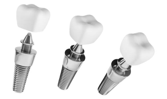 dental implant photo_edited.png