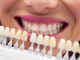 Dental Zirconium Crown.