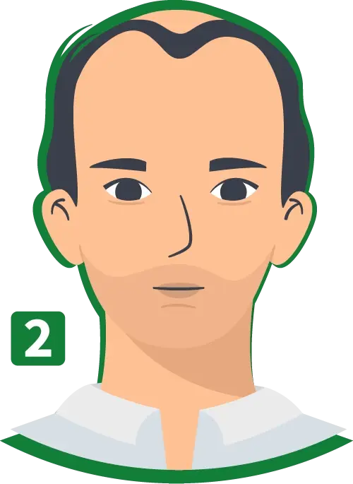 Calvo-P2-min.webp